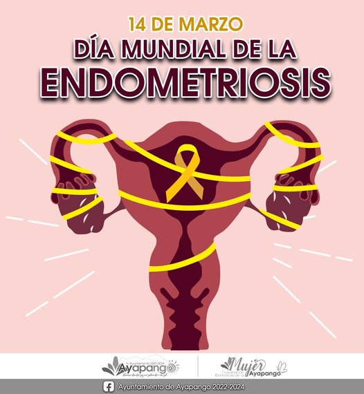 Hoy es el Día Mundial de la Endometriosis una patología