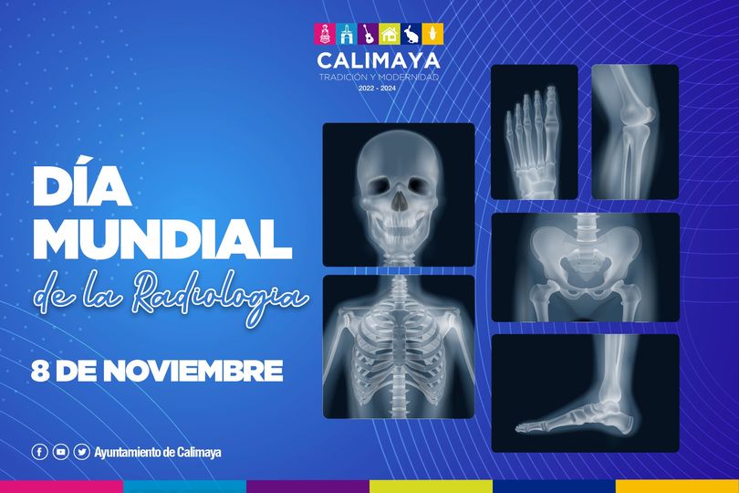 1667926771 El 8 de noviembre es el DiaMundialDeLaRadiologia una fecha ideal