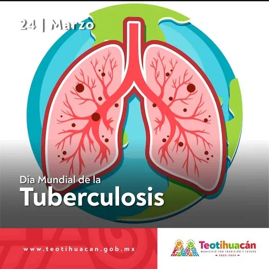 1679680668 Enfermedad bacteriana infecciosa que afecta principalmente a los pulmones jpg