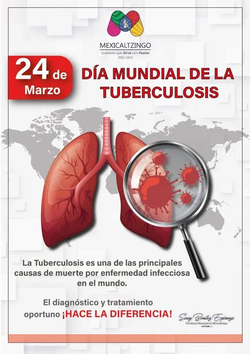 1679699209 Dia Mundial de la Tuberculosis en 2023 I Si podemos jpg