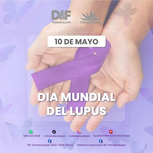 1683734797 El lupus es una enfermedad autoinmune es decir el propio jpg