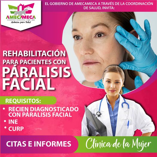 ¿Requieres de una rehabilitacion por paralisis facial